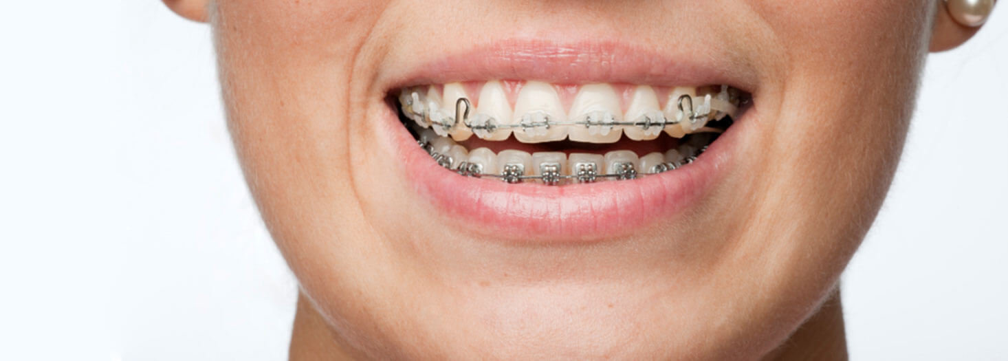 Master's Degree in Specialization in Orthodontics